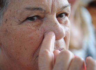 Pesquisadores desenvolvem software para diagnosticar melanoma