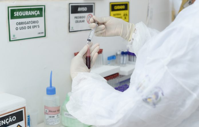 Laboratório Municipal de Palmas amplia a testagem com a chegada de mais 2.500 testes rápidos de Covid-19