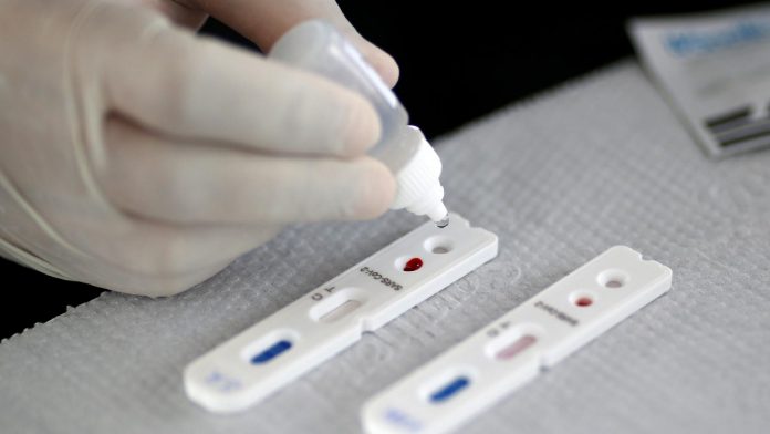Após mutirão de testes, Palmas registra 566 novos casos neste domingo, 16; Semus alerta para número de crianças contaminadas