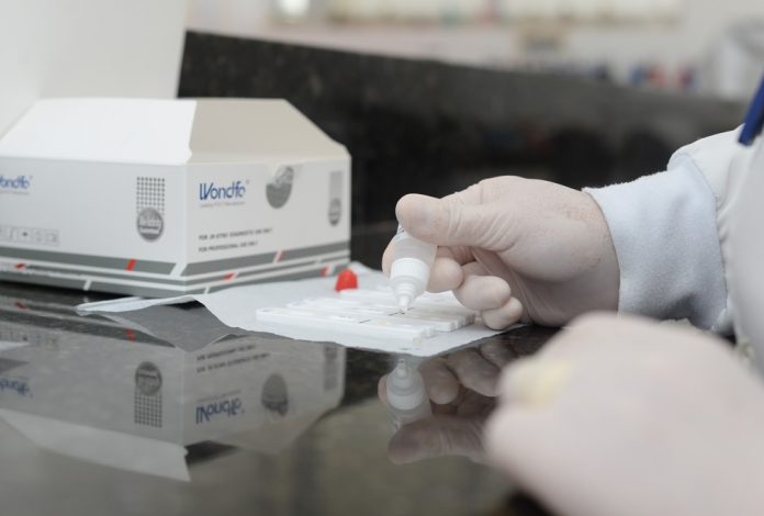 Palmas tem mais uma unidade sentinela para coleta de material biológico para exames da Covid-19