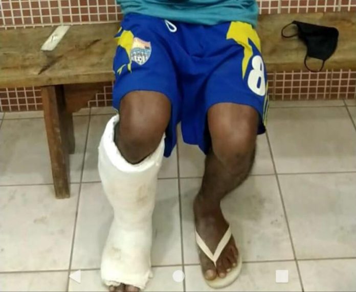 Com falsa fratura na perna, homem é flagrado tentando ingressar na CPP de Palmas com celulares escondidos em gesso
