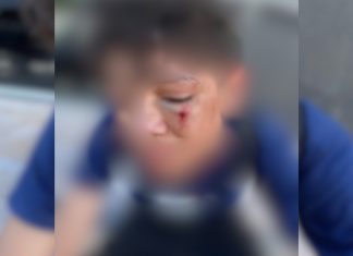 Família denuncia agressão a aluno após caso de bullying em escola no Tocantins
