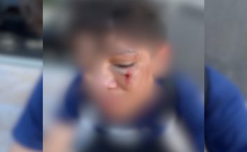 Família denuncia agressão a aluno após caso de bullying em escola no Tocantins