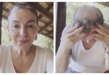 Mãe de Lucas Lucco revela volta de alopecia areata e desabafa nas redes: ‘Vou seguir firme’